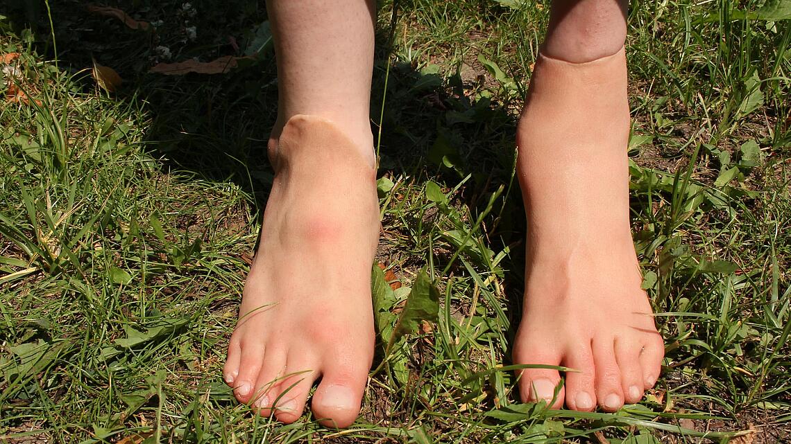 linke und rechte Fußprothese aus Silikon im Gras