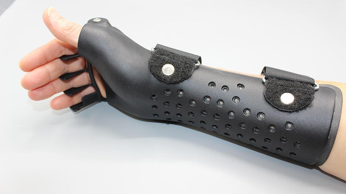 schwarze Ulnardeviationsorthesen aus dem 3D-Drucker