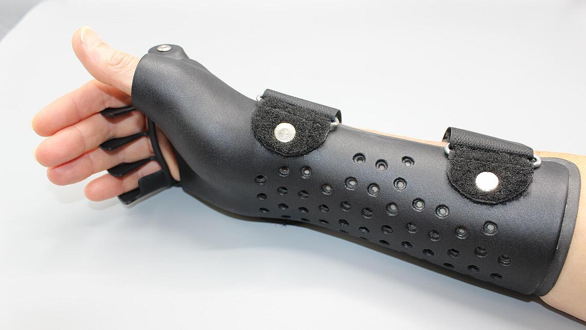 Ulnardeviationsorthesen aus dem 3D-Drucker schwarze Ulnardeviationsorthesen aus dem 3D-Drucker