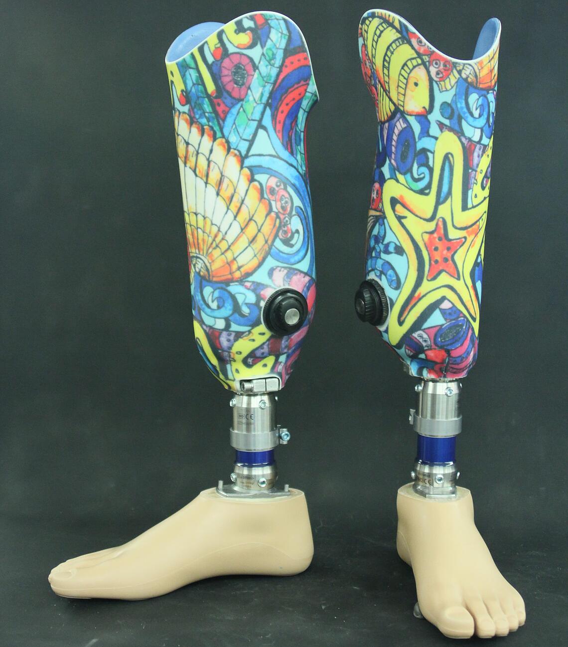 doppelseitige Unterschenkel-Prothese mit buntem Deko-Strumpf