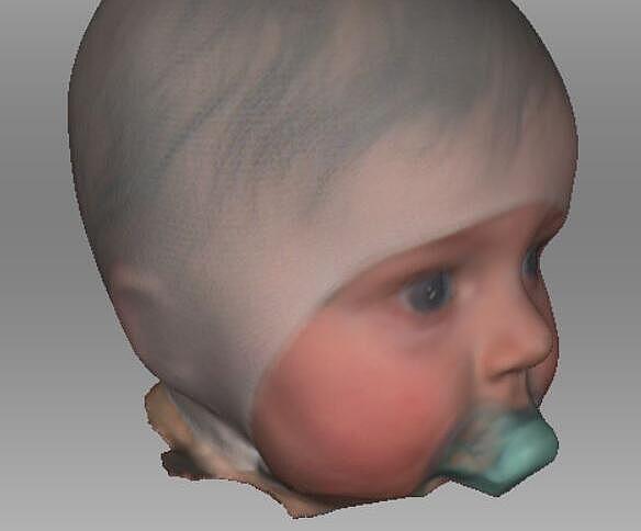 Kopf-Scans in 3D eines Säuglings