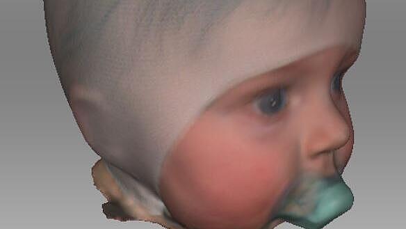 Kopf-Scans in 3D eines Säuglings