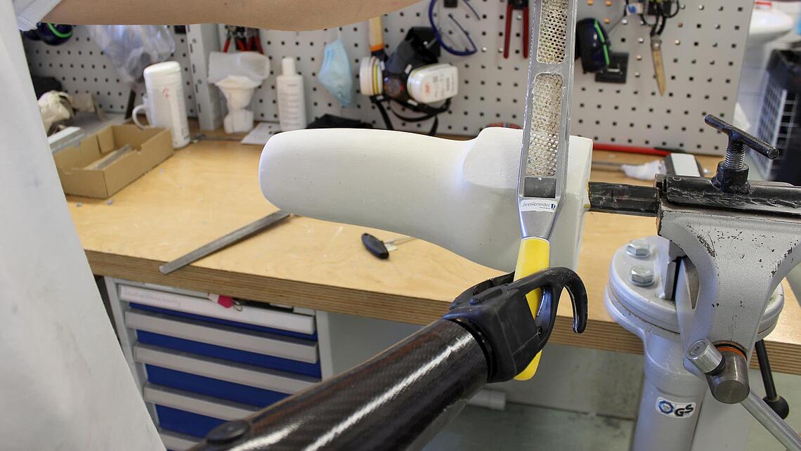 Unterarmprothese mit Greifer, der Gips feilt