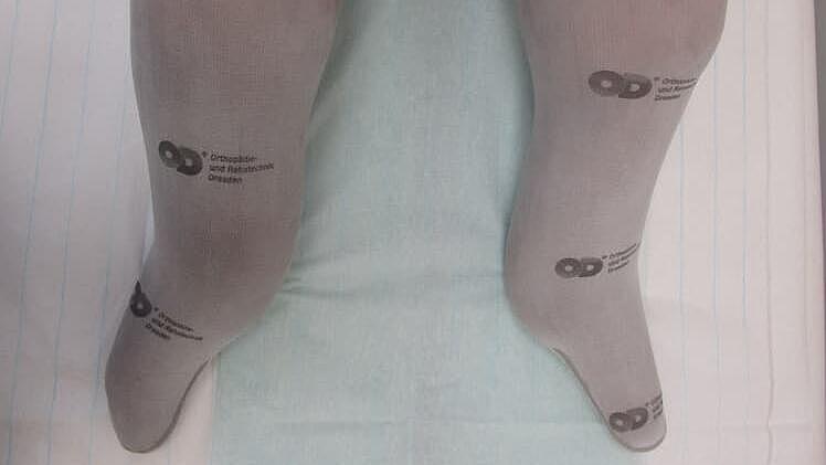 Liner auf Beinstümpfen für eine optimale Verbindung zur Prothese