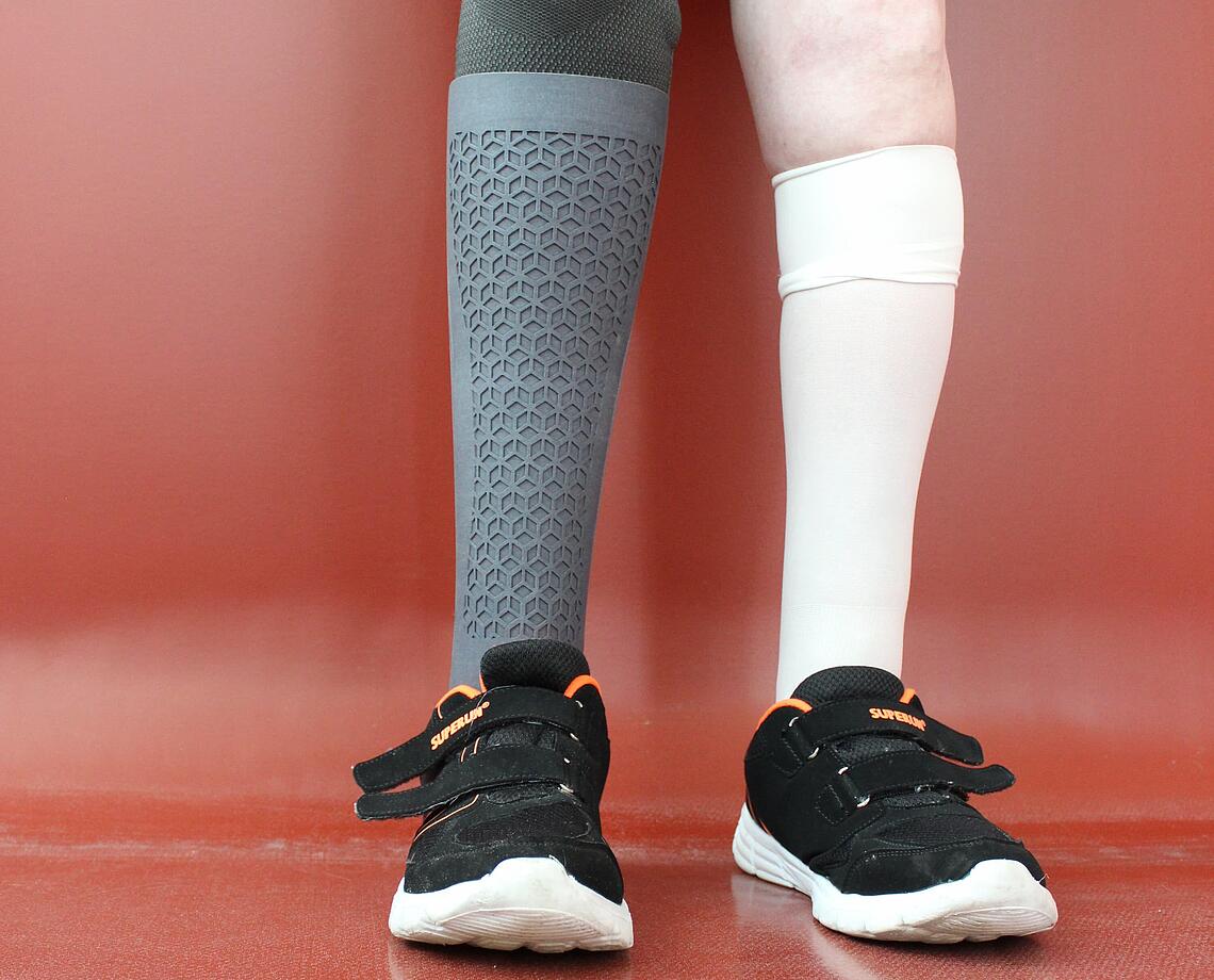 graues, individuelles Cover einer Unterschenkel-Prothese aus dem 3D-Drucker