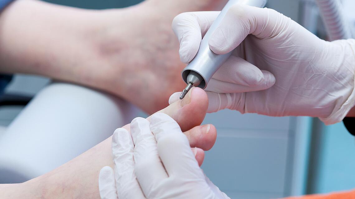 Feilen eines Zehennagels mit elektrischer Feile in der Podologie