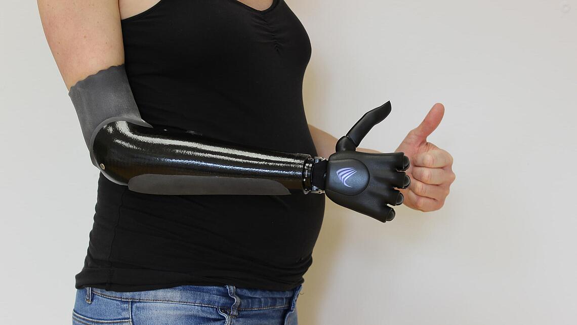Daumen hoch mit einer myoelektrische Handprothese
