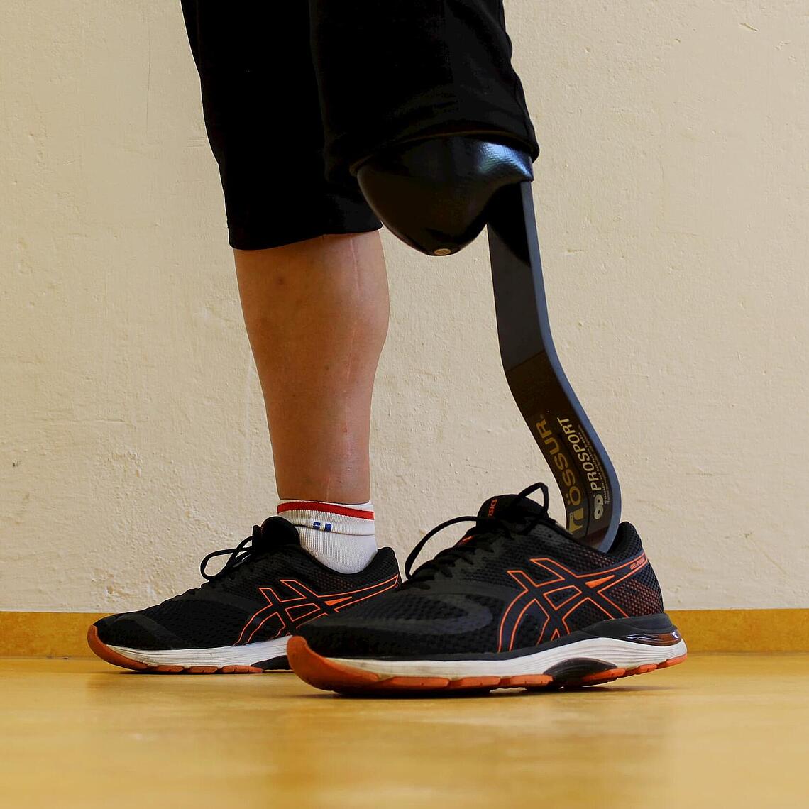 ein natürliches Bein und eine Unterschenkel-Prothese als Feder im Turnschuh