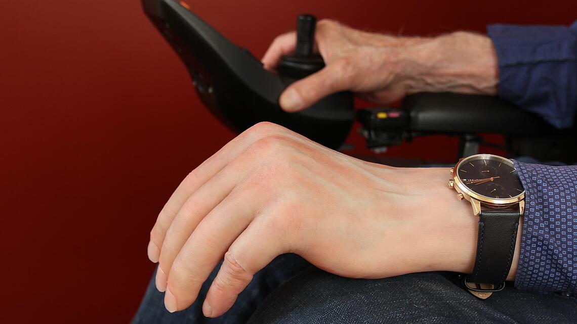 angezogene Unterarmprothese aus Silikon mit Armbanduhr